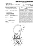 IDENTIFICATION OF DYSYNCHRONY USING INTRACARDIAC ELECTROGRAM DATA diagram and image