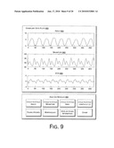 Cardiac Resynchronization Therapy Optimization Using Vector Measurements Obtained from Realtime Electrode Position Tracking diagram and image