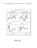 Cardiac Resynchronization Therapy Optimization Using Vector Measurements Obtained from Realtime Electrode Position Tracking diagram and image