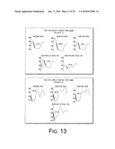 Cardiac Resynchronization Therapy Optimization Using Vector Measurements Obtained from Realtime Electrode Position Tracking diagram and image