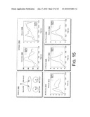 Cardiac Resynchronization Therapy Optimization Using Vector Measurements Obtained from Realtime Electrode Position Tracking diagram and image