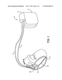 MEDICAL DEVICE SENSING AND DETECTION DURING MRI diagram and image