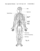 Systems and methods to place one or more leads in tissue to electrically stimulate nerves of passage to treat pain diagram and image