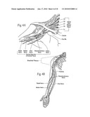 Systems and methods to place one or more leads in tissue to electrically stimulate nerves of passage to treat pain diagram and image