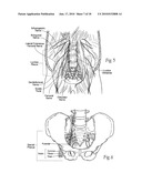 Systems and methods to place one or more leads in tissue to electrically stimulate nerves of passage to treat pain diagram and image