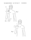 Systems and methods to place one or more leads in tissue for providing functional and/or therapeutic stimulation diagram and image