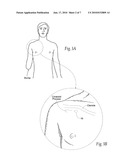 Systems and methods to place one or more leads in tissue for providing functional and/or therapeutic stimulation diagram and image