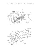 Systems and methods to place one or more leads in tissue for providing functional and/or therapeutic stimulation diagram and image