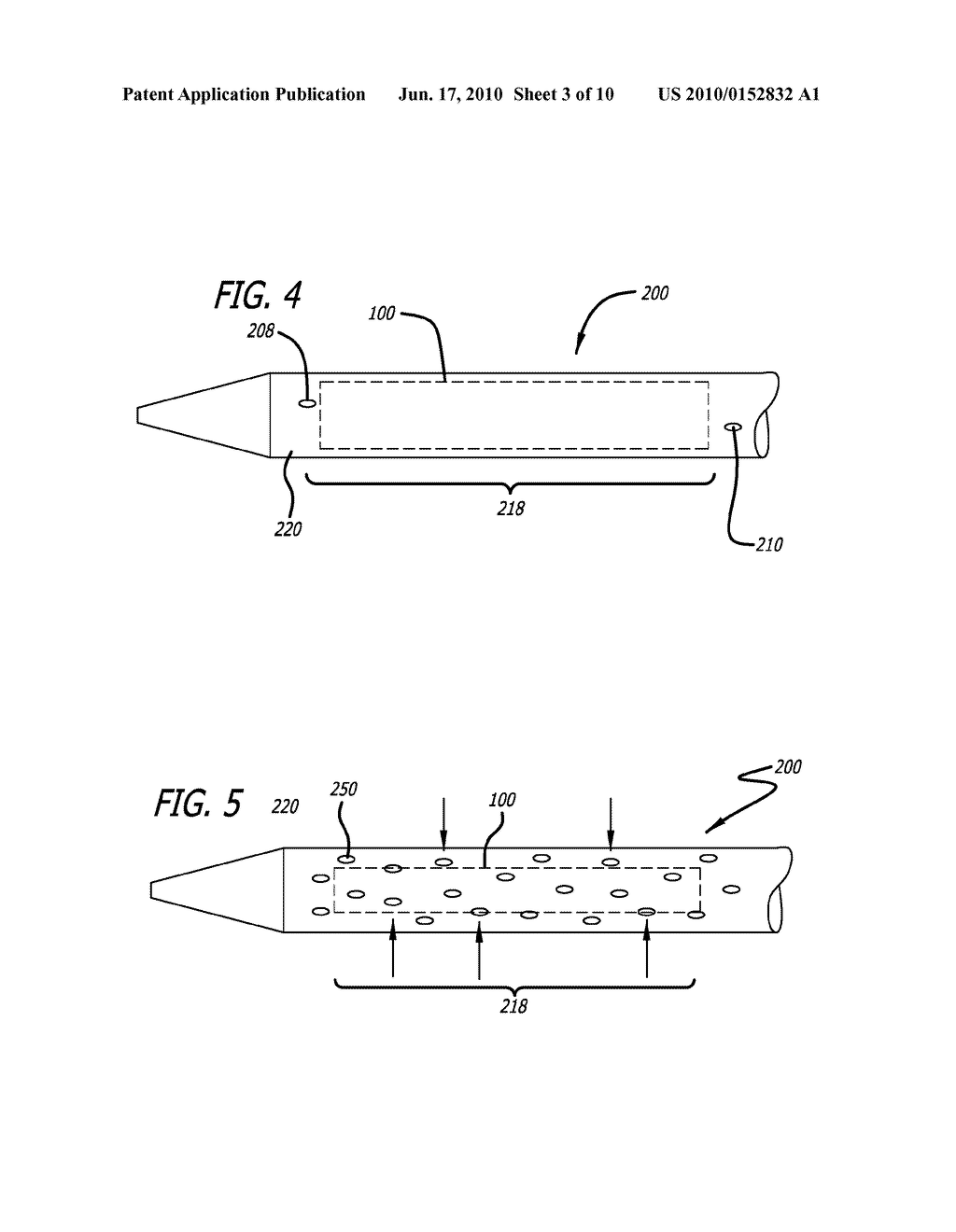 Apparatus and Methods for Treatment of Aneurysms With Fibrin Derived Peptide B-Beta - diagram, schematic, and image 04