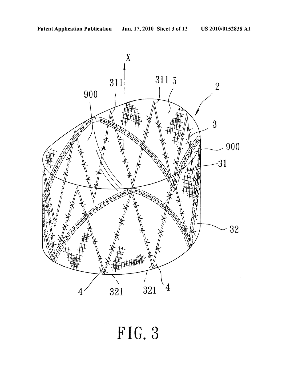 Implantable Valvular Prosthesis - diagram, schematic, and image 04