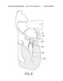 Implantable Valvular Prosthesis diagram and image