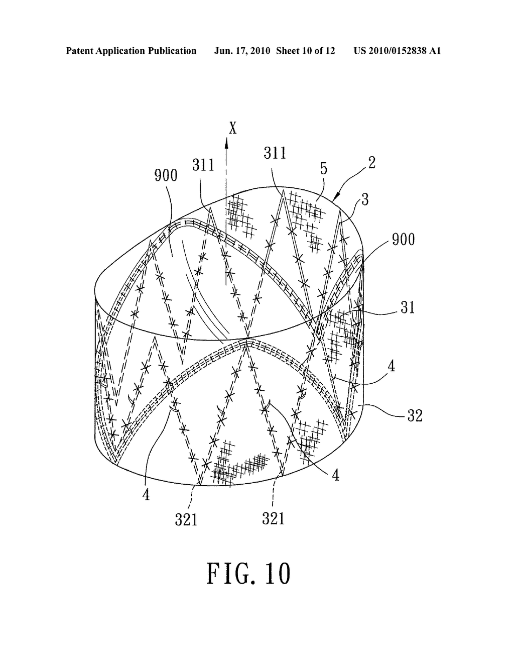 Implantable Valvular Prosthesis - diagram, schematic, and image 11