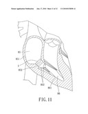 Implantable Valvular Prosthesis diagram and image