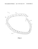 ANNULOPLASTY RING WITH DIRECTIONAL FLEXIBILITIES AND RIGIDITIES TO ASSIST THE MITRAL ANNULUS DYNAMICS diagram and image