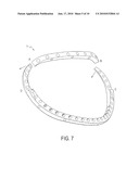 ANNULOPLASTY RING WITH DIRECTIONAL FLEXIBILITIES AND RIGIDITIES TO ASSIST THE MITRAL ANNULUS DYNAMICS diagram and image