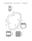 ANNULOPLASTY RING WITH DIRECTIONAL FLEXIBILITIES AND RIGIDITIES TO ASSIST THE MITRAL ANNULUS DYNAMICS diagram and image