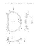 ANNULOPLASTY RING WITH DIRECTIONAL FLEXIBILITIES AND RIGIDITIES TO ASSIST THE MITRAL ANNULUS DYNAMICS diagram and image