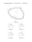 ANNULOPLASTY RING WITH DIRECTIONAL FLEXIBILITIES AND RIGIDITIES TO ASSIST THE MITRAL ANNULUS DYNAMICS diagram and image