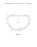 ANNULOPLASTY RING WITH DIRECTIONAL FLEXIBILITIES AND RIGIDITIES TO ASSIST THE MITRAL ANNULUS DYNAMICS diagram and image