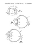 Intraocular Lens and Method of Making an Intraocular Lens diagram and image