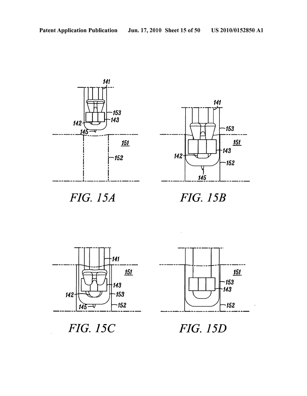 DEVICES, SYSTEMS AND METHODS FOR MATERIAL FIXATION - diagram, schematic, and image 16