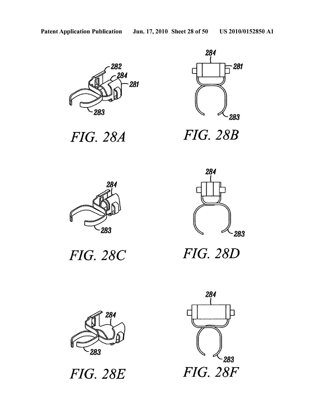 DEVICES, SYSTEMS AND METHODS FOR MATERIAL FIXATION - diagram, schematic, and image 29