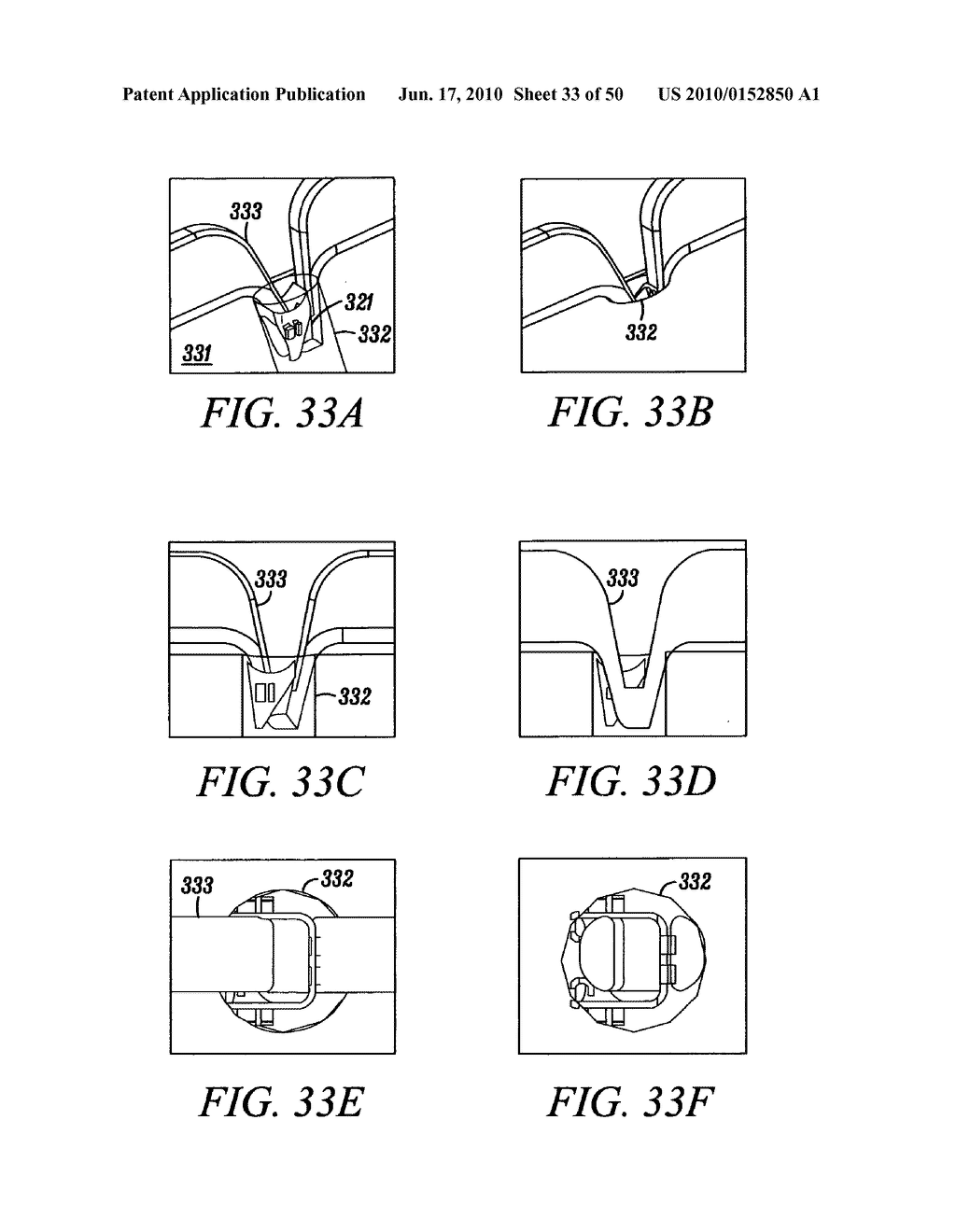 DEVICES, SYSTEMS AND METHODS FOR MATERIAL FIXATION - diagram, schematic, and image 34