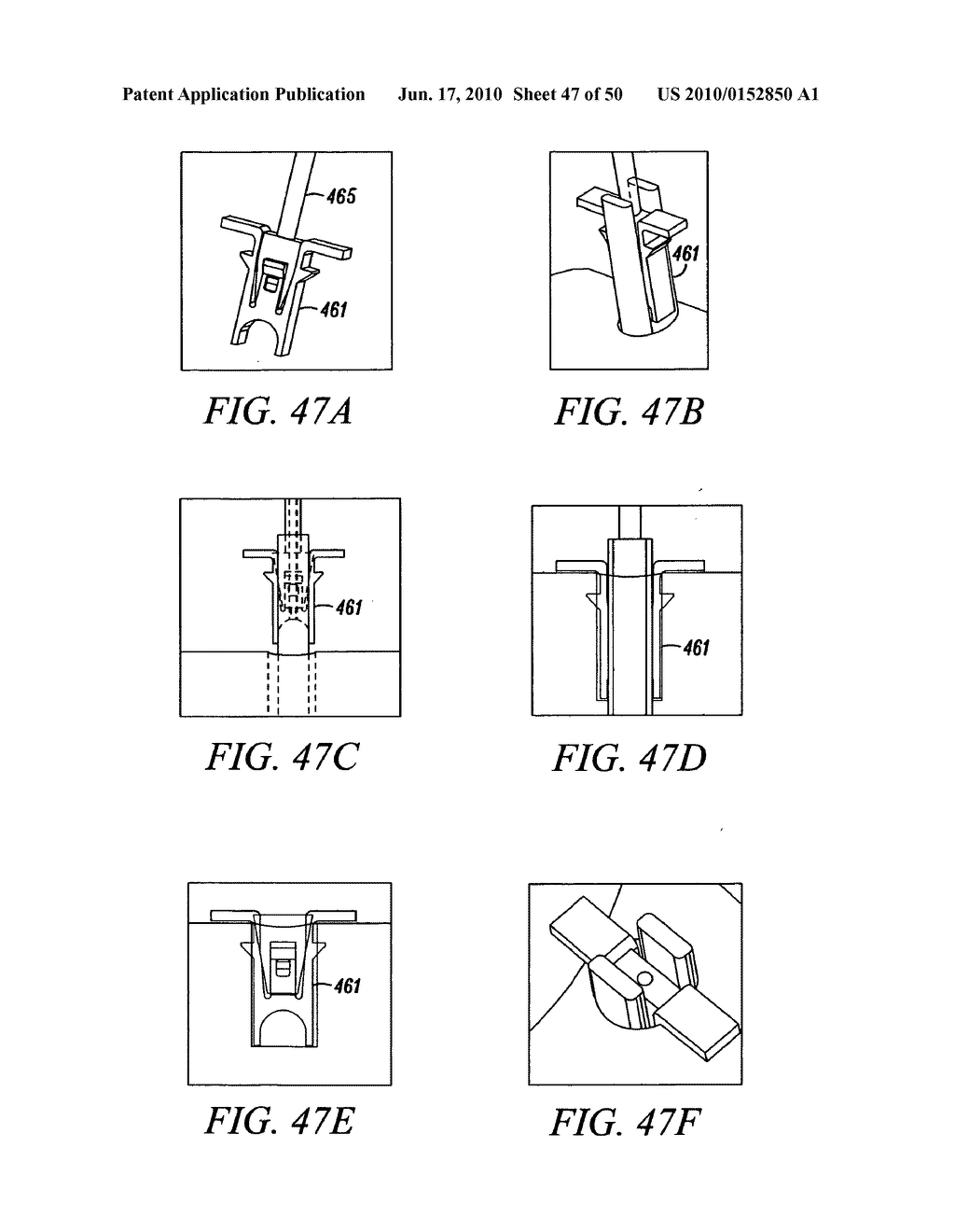 DEVICES, SYSTEMS AND METHODS FOR MATERIAL FIXATION - diagram, schematic, and image 48