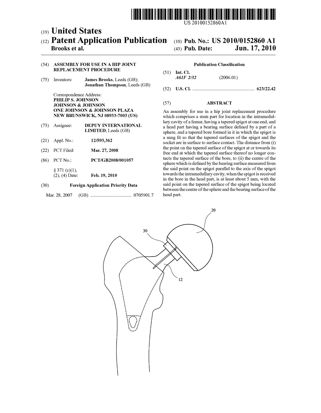  ASSEMBLY FOR USE IN A HIP JOINT REPLACEMENT PROCEDURE - diagram, schematic, and image 01