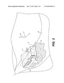 Slippage condition response system diagram and image