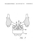 Accessory mount apparatus diagram and image