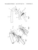 ADJUSTABLE LEVER ARM CAPO diagram and image