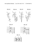 UNIVERSALLY ATTACHABLE FORWARD TACKING SAIL RIG WITH CANTING INTEGRATED MAST AND WATER FOIL FOR ALL BOATS diagram and image