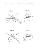 UNIVERSALLY ATTACHABLE FORWARD TACKING SAIL RIG WITH CANTING INTEGRATED MAST AND WATER FOIL FOR ALL BOATS diagram and image