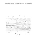 Segmented Tubular Body diagram and image