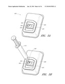 METHODS AND SYSTEMS FOR STORING MEDICAL IMPLANTS UNDER SUSTAINED VACUUM diagram and image