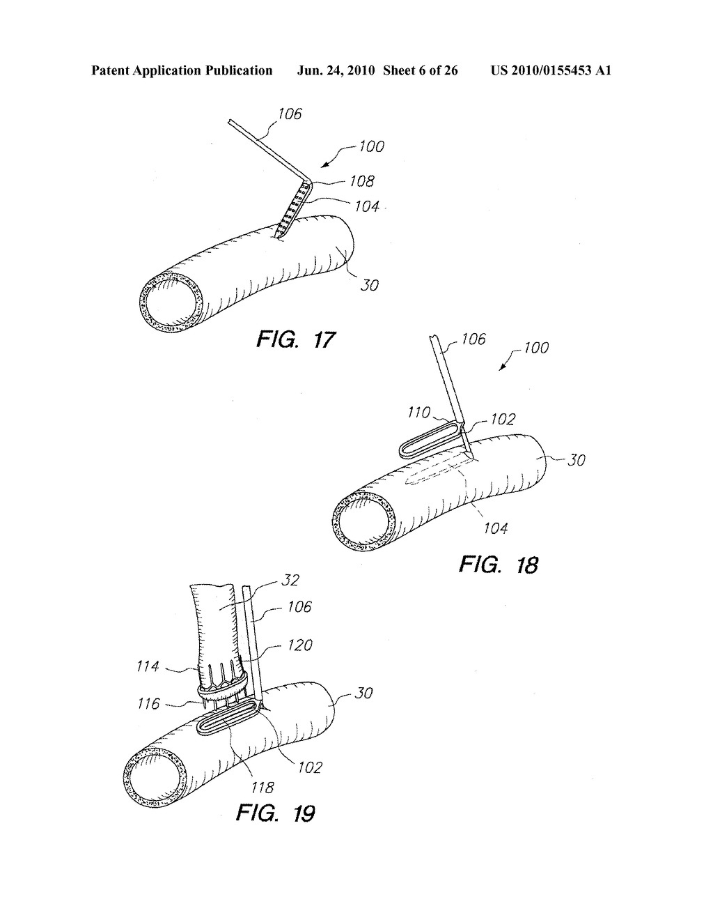 Surgical Staples Frangibly Connected to Staple Holding Strip - diagram, schematic, and image 07