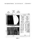 SYSTEM AND METHOD FOR IMPROVING THE QUALITY OF THERMAL IMAGES diagram and image