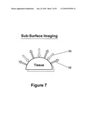 Hand-Held Optical Probe Based Imaging System with 3D Tracking Facilities diagram and image