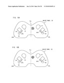 AIRBAG, AIRBAG DEVICE, AND VEHICLE diagram and image