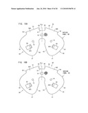 AIRBAG, AIRBAG DEVICE, AND VEHICLE diagram and image