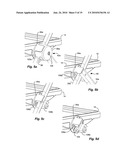 CLAMPING JOINT FOR A CHAIR diagram and image