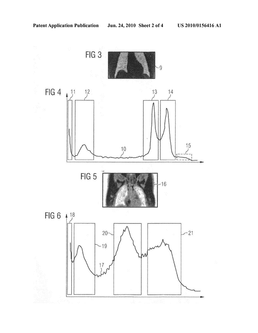 Method and apparatus for processing combined MR/emission tomography recordings - diagram, schematic, and image 03