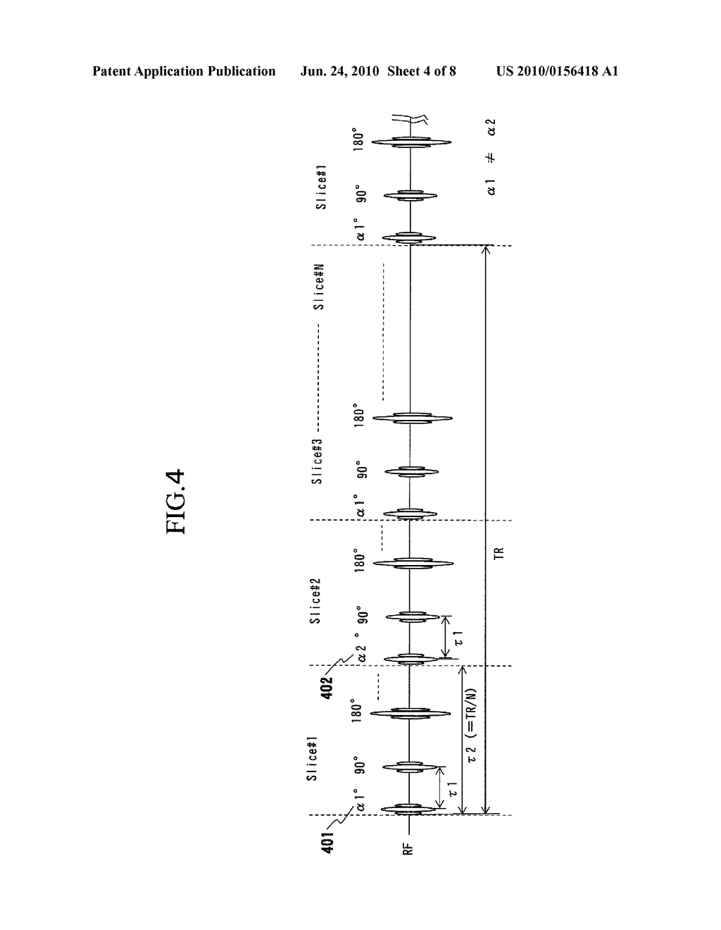 MAGNETIC RESONANCE IMAGING APPARATUS AND MAGNETIC RESONANCE IMAGING METHOD - diagram, schematic, and image 05