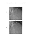 AUTOMATIC STABILIZATION OF AN IMAGE STREAM OF A MOVING ORGAN diagram and image