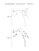 AUTOMATIC STABILIZATION OF AN IMAGE STREAM OF A MOVING ORGAN diagram and image