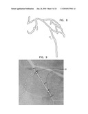 AUTOMATIC STABILIZATION OF AN IMAGE STREAM OF A MOVING ORGAN diagram and image