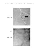 AUTOMATIC STABILIZATION OF AN IMAGE STREAM OF A MOVING ORGAN diagram and image