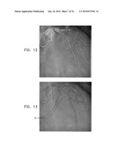 AUTOMATIC STABILIZATION OF AN IMAGE STREAM OF A MOVING ORGAN diagram and image