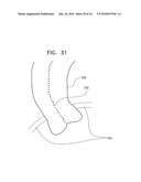 AUTOMATIC STABILIZATION OF AN IMAGE STREAM OF A MOVING ORGAN diagram and image